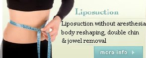 liposuction