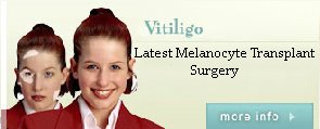 vitiligo