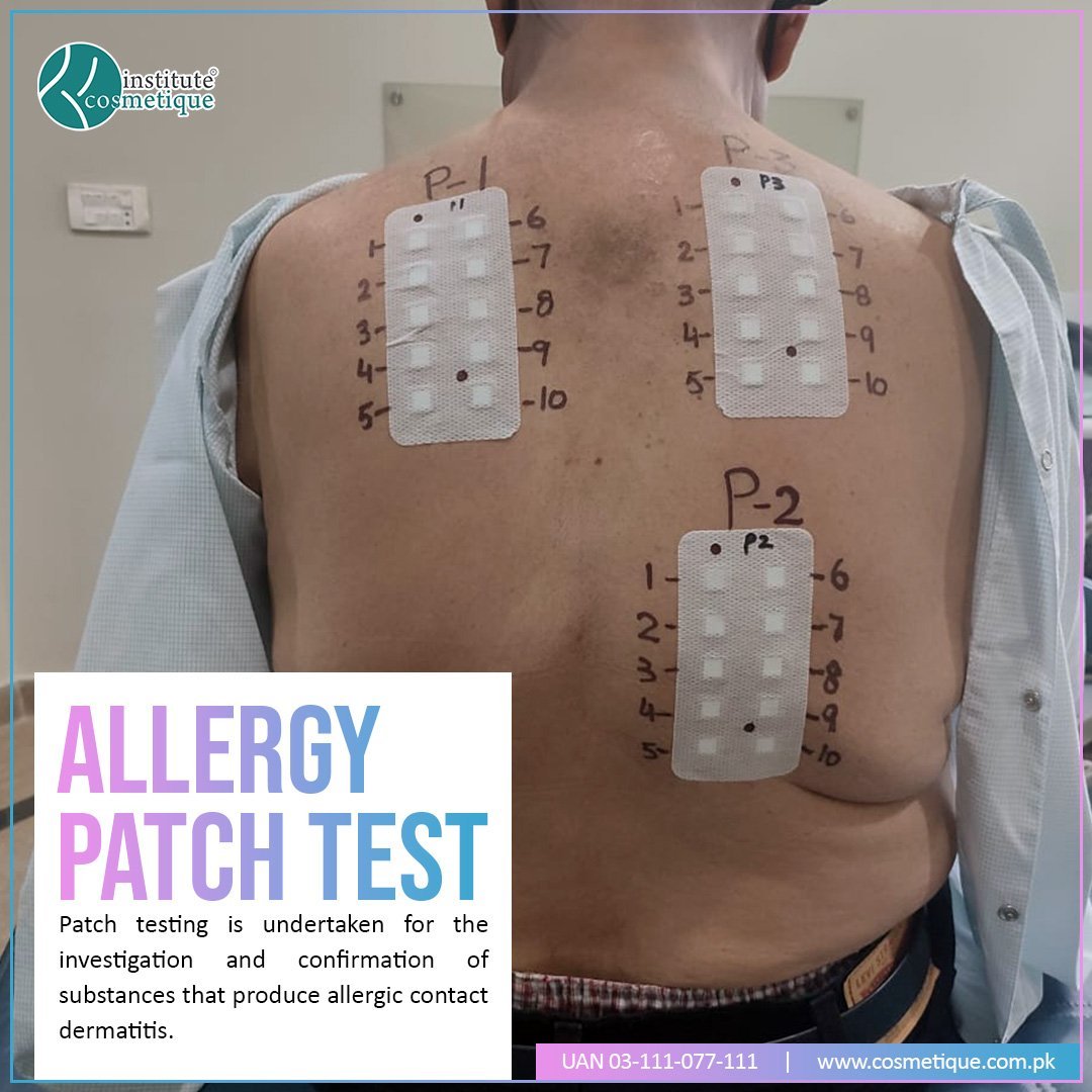 Allergy Patch Test