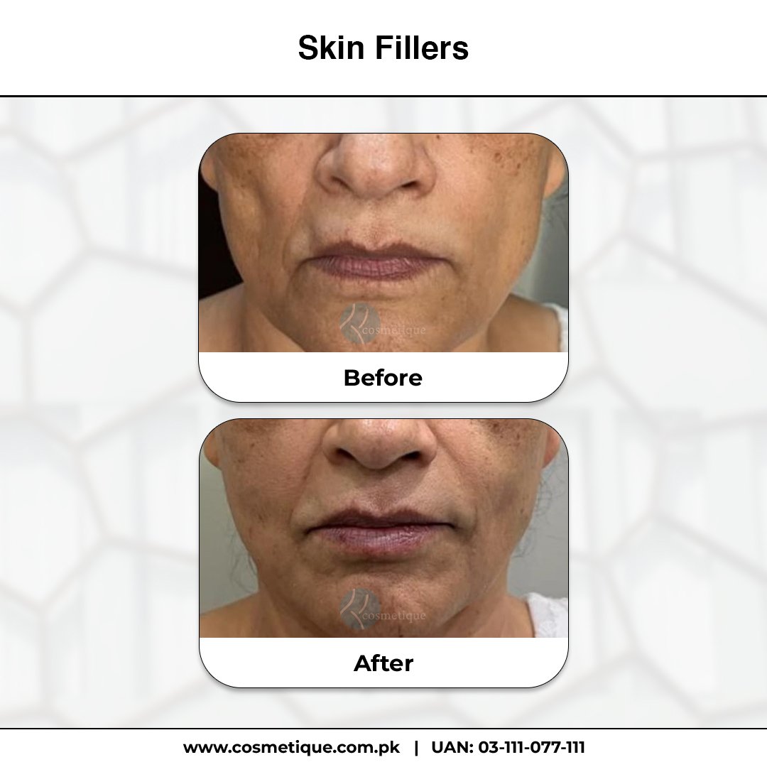 Expert dermatologist performing skin treatment at Institute Cosmetique