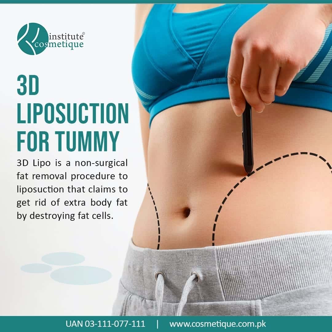 Liposuction Method Liposuction Surgery